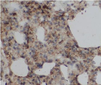 anti- MSK1 antibody