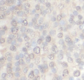 anti- 4EBP1 antibody