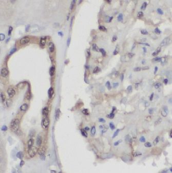  HIF1a ( 1-,  , Hypoxia-inducible factor 1-alpha) / anti- HIF1a antibody