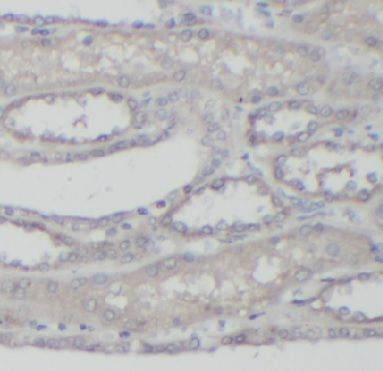 anti- ABCC6 antibody