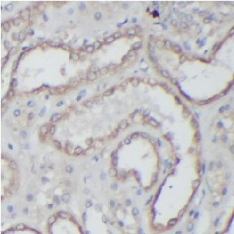 anti- HK1 antibody