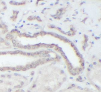 anti- ATM antibody