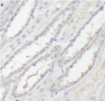 anti- EIF4E antibody