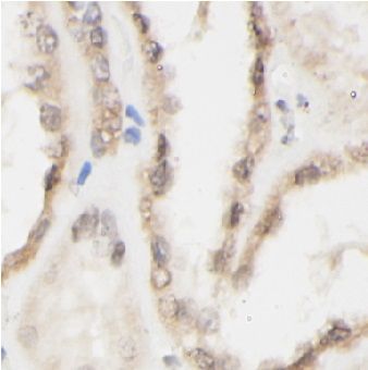 anti- CD154 antibody