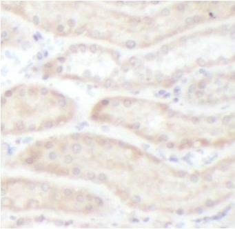 anti- FZD4 antibody