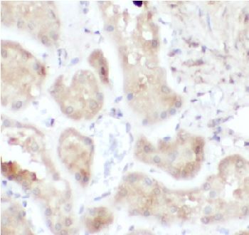 anti- ATG12 antibody