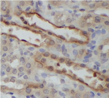 anti- RAF1 antibody