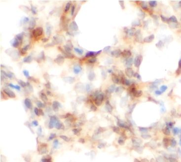 anti- Amphiregulin antibody