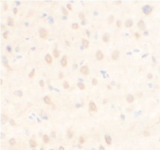 anti- ARPC5L antibody