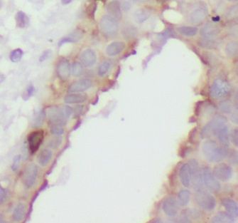 anti- CaMKII delta antibody