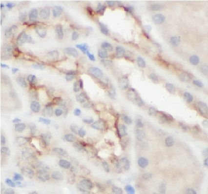 anti- CAPRIN2 antibody