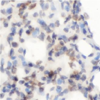   RAGE (Advanced glycosylation end product-specific receptor, Receptor for advanced glycosylation end products, AGER|  / anti- AGER antibody