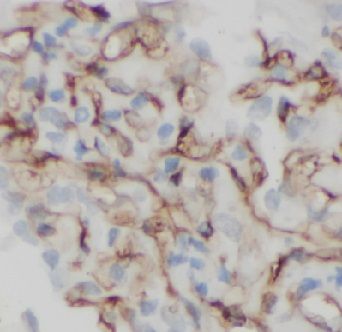 anti- CD34 antibody