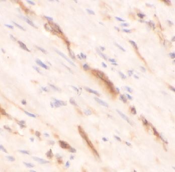 anti- GREM1 antibody