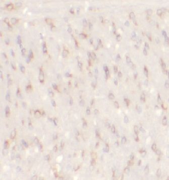 anti- BACE1 antibody