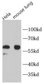 anti- Beclin 1 antibody