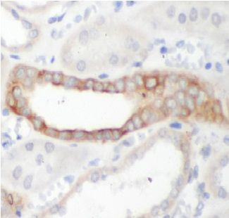 anti- ATF4 antibody