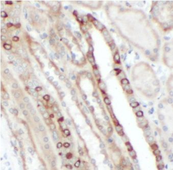 anti- FGFR1 antibody