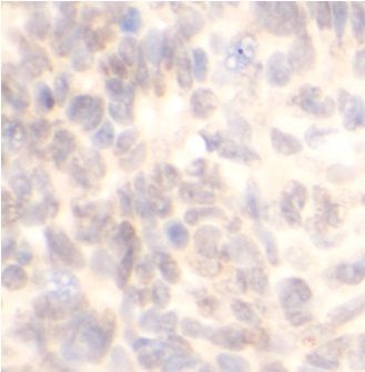 anti- Caveolin-1 antibody