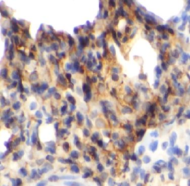 anti- PFKFB3 antibody