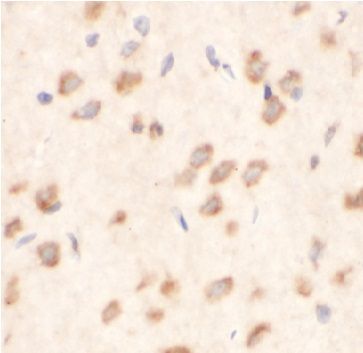 anti- AEG-1 antibody