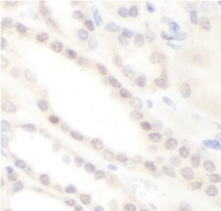 anti- CAB39L antibody