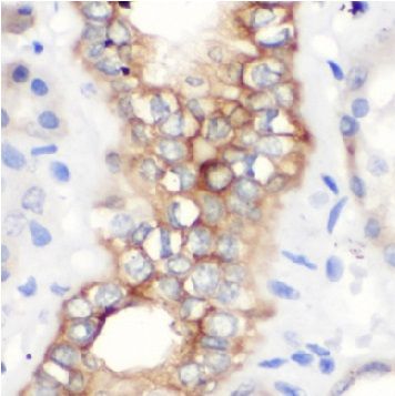 anti- Autotaxin antibody