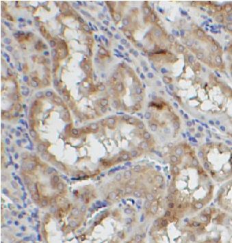 anti- TAB3 antibody