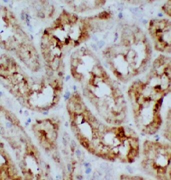 anti- SDC4 antibody