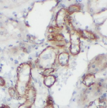 anti- AGR2 antibody