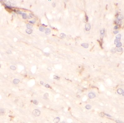 anti- CD81 (TAPA1) antibody