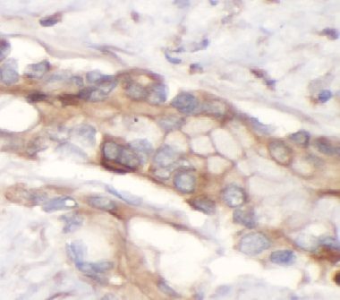 anti- EAAT2 antibody