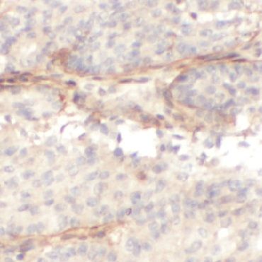 anti- Fibronectin antibody