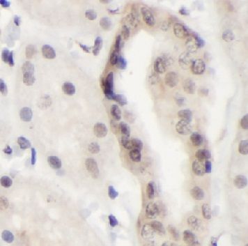 anti- NFATC3 antibody