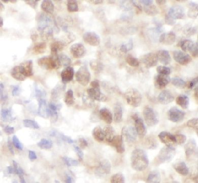 anti- NOP58 antibody
