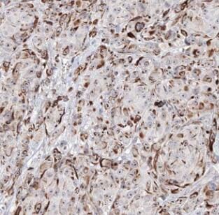 Anti-NCR1 antibody