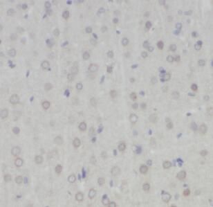 anti-HTR1A antibody