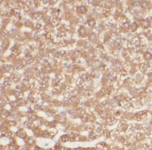 anti-Piezo2 antibody