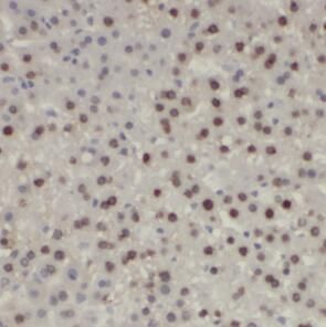 anti-SP1 antibody