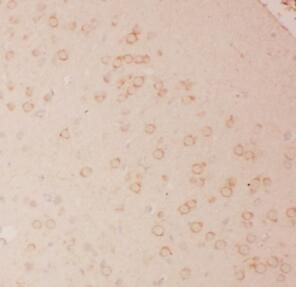anti-IL-13 antibody