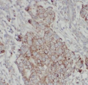 anti-MMP16 antibody