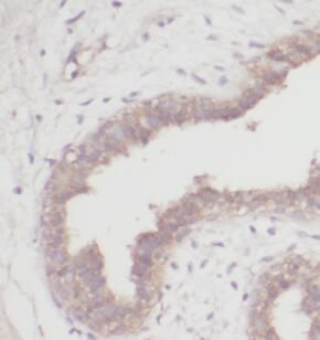 anti-DMP1 antibody