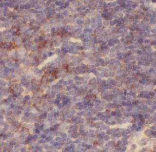 anti-CHAF1b antibody