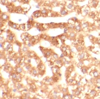 anti- FTH1 antibody