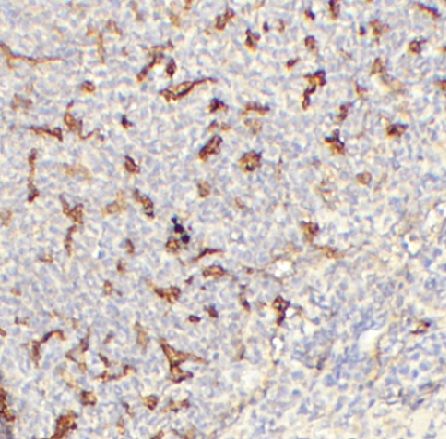 anti- TNFRSF11B antibody