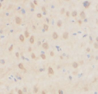     1 (MTNR1A antibody) / anti- MTNR1A antibody