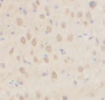 anti- MTNR1A antibody