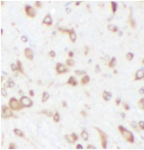 anti- CPT1C antibody