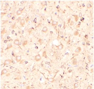 anti- Kisspeptin antibody