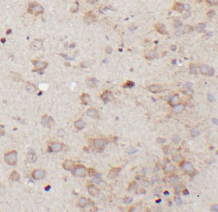 anti- Nestin antibody